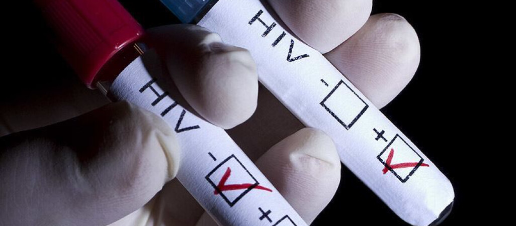 Zrób test na HIV – anonimowo i bezpłatnie