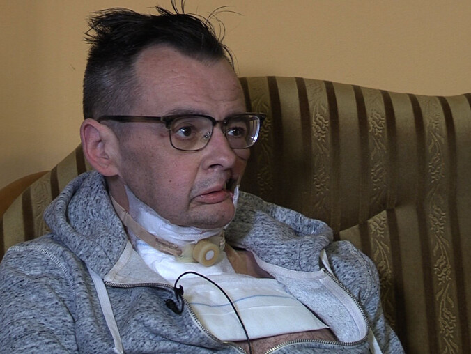 Potrzeba 170 tys zł na "nową" twarz dla Tomka - grafika