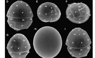 Glony Parvodinium marciniakii i Parvodinium trawinskii