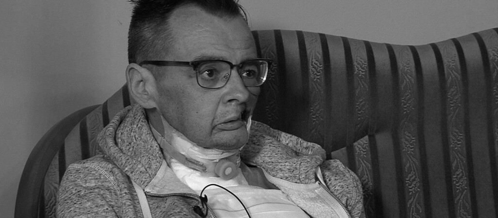 Tomasz Zaciera przegrał walkę z rakiem twarzy