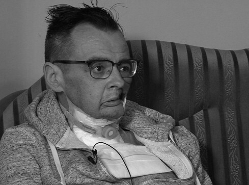 Tomasz Zaciera przegrał walkę z rakiem twarzy - grafika