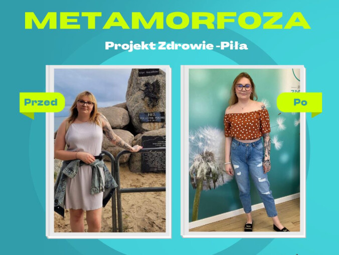 Metamorfoza z Projekt Zdrowie w Pile - grafika