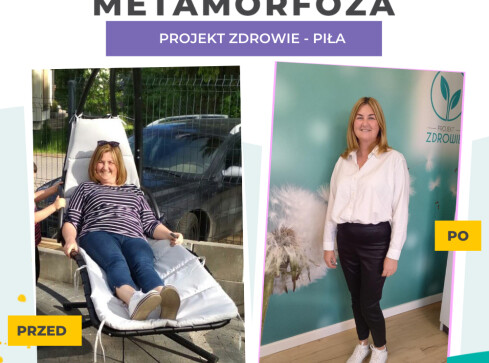 Schudnij z Projektem Zdrowie Piła - grafika