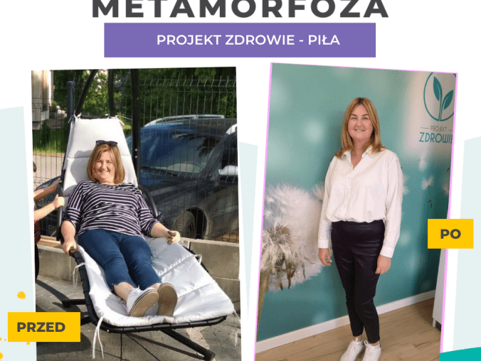 Schudnij z Projektem Zdrowie Piła - grafika