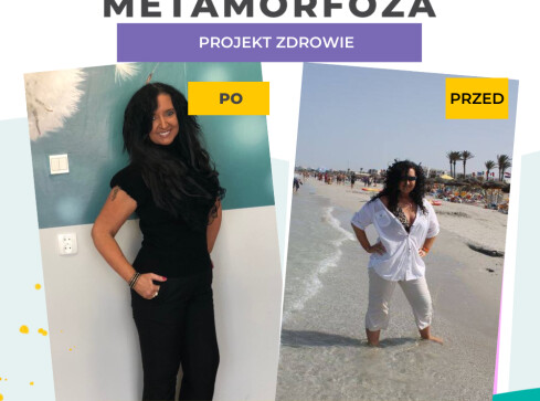 - 33 kg z Centrum Dietetycznym Projekt Zdrowie - grafika