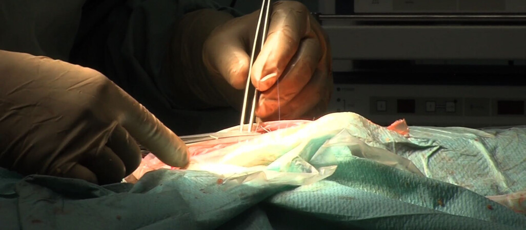 Wyrzyska chirurgia do likwidacji