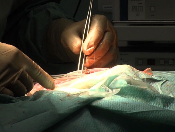 Wyrzyska chirurgia do likwidacji  - grafika