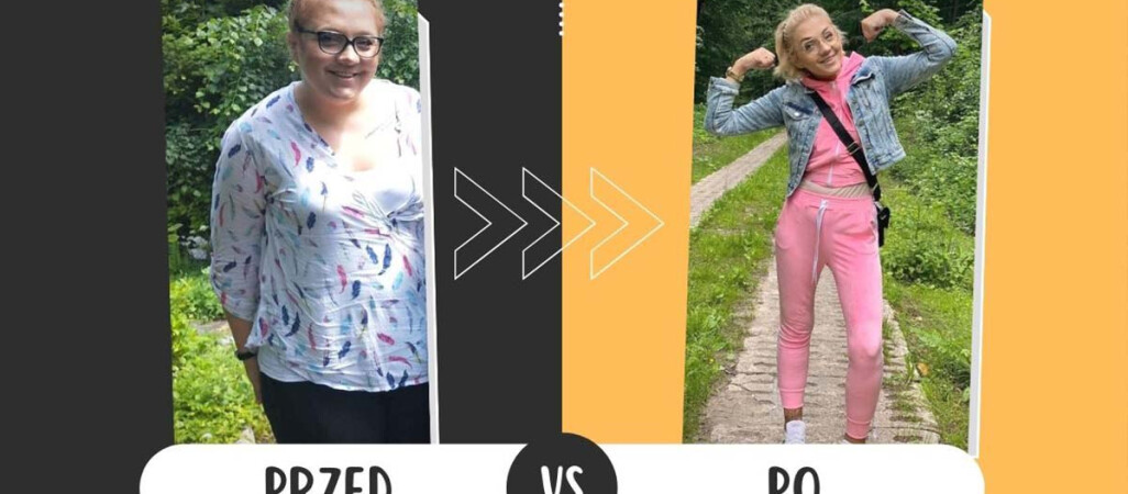 Zmniejszyła sobie żołądek. Dziś jest lżejsza o 82 kilogramy