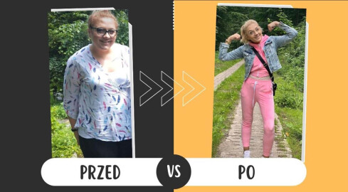 Zmniejszyła sobie żołądek. Dziś jest lżejsza o 82 kilogramy - grafika