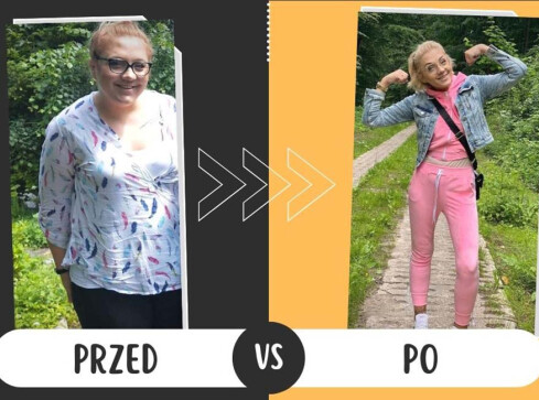 Zmniejszyła sobie żołądek. Dziś jest lżejsza o 82 kilogramy - grafika