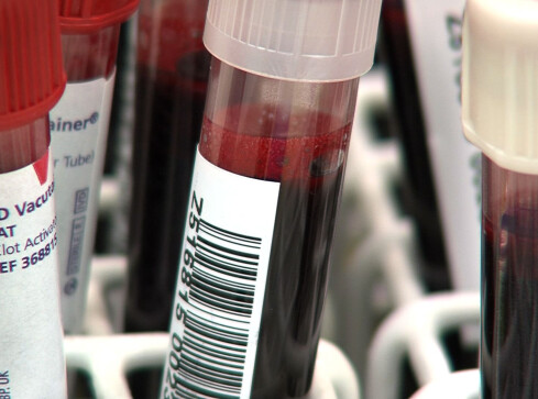 Dramatycznie brakuje krwi. Centrum krwiodawstwa apeluje - grafika