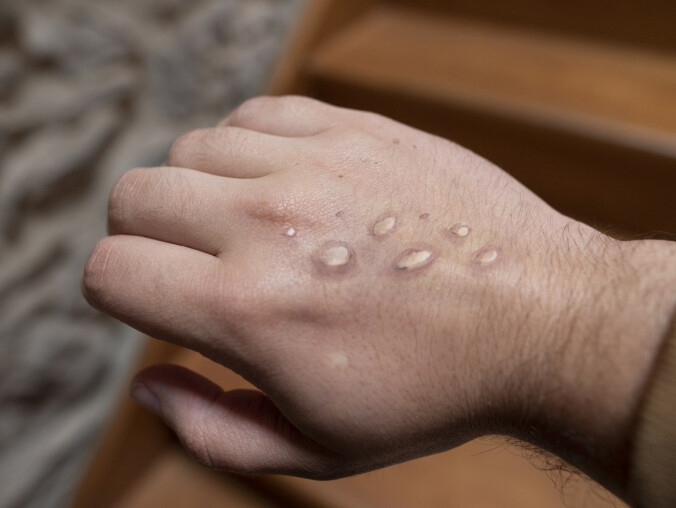 Będzie obowiązek izolacji. Nie chodzi tu jednak o COVID-19 - grafika