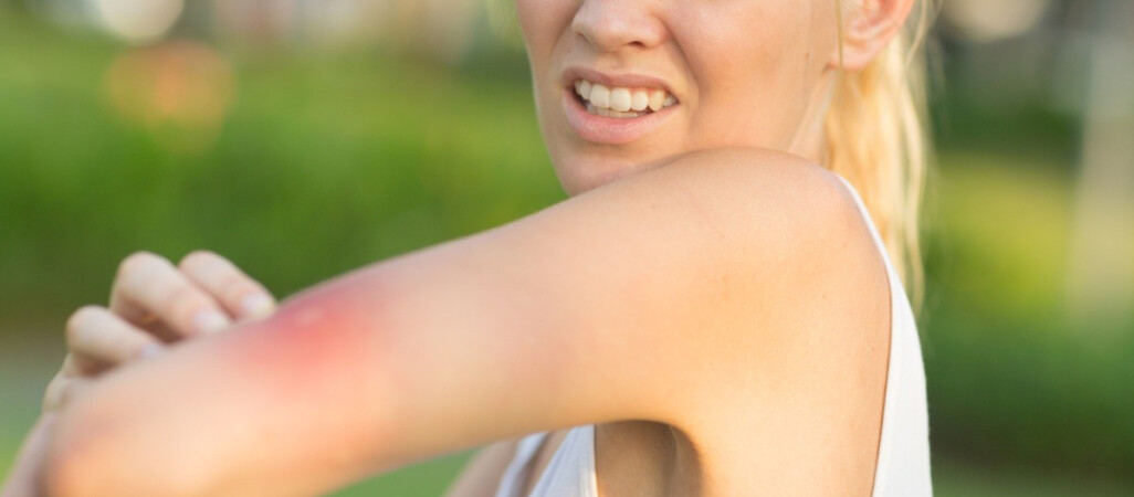 Co stosować na ugryzienia przez muchy końskie, meszki i komary?