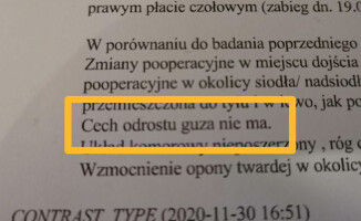 Filip Kaźmierczak jest zdrowy. Zdrowie zawdzięcza pilanom