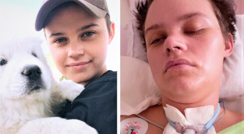 25-letnia Kornelia wymaga kosztownej rehabilitacji po wypadku  - grafika