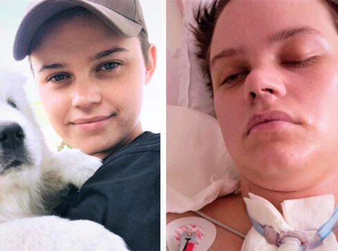 25-letnia Kornelia wymaga kosztownej rehabilitacji po wypadku  - grafika