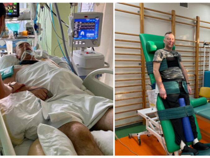 Krzysztof Bielawski z Piły cudem przeżył wypadek. Teraz potrzebuje  - grafika