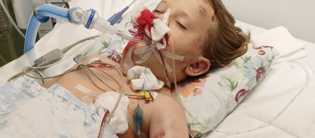 Leoś z Chodzieży potrzebuje wsparcia. Przeżył wypadek drogowy