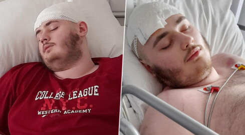 Michał potrzebuje drogiego leku. 18-latek ma guza mózgu  - grafika
