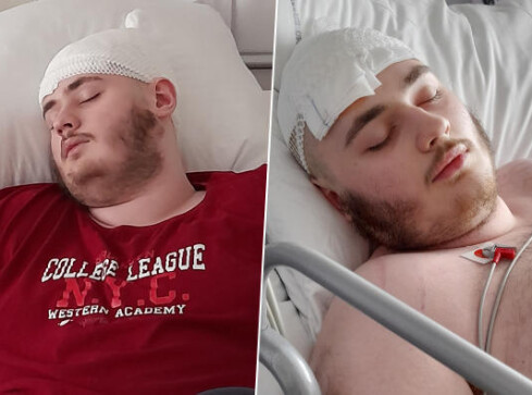 Michał potrzebuje drogiego leku. 18-latek ma guza mózgu  - grafika