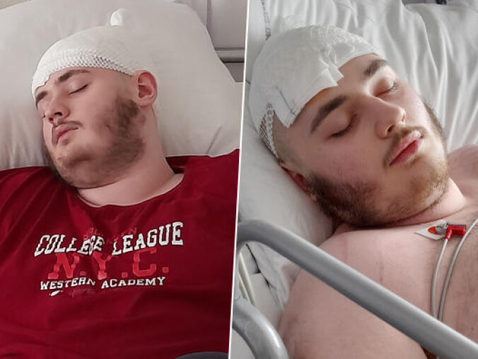 Michał potrzebuje drogiego leku. 18-latek ma guza mózgu  - grafika