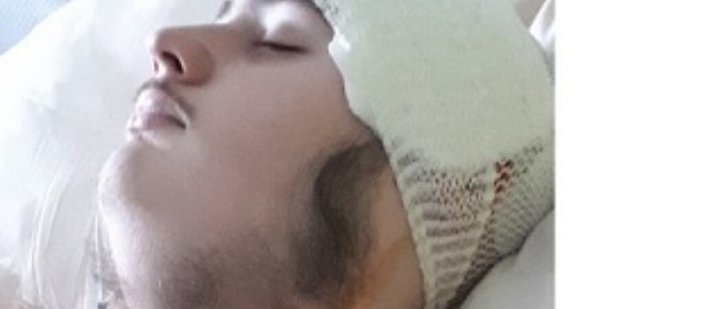 17-letni Michał walczy z guzem mózgu. Potrzebuje wsparcia 