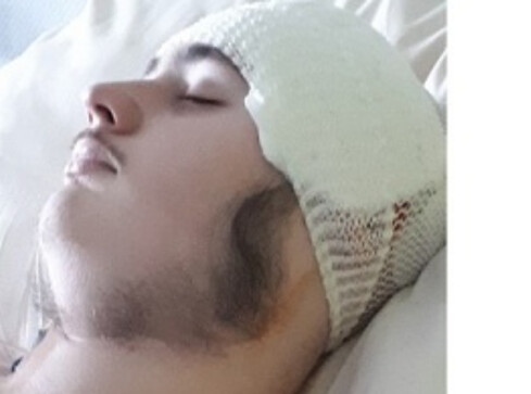 17-letni Michał walczy z guzem mózgu. Potrzebuje wsparcia  - grafika