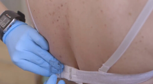 „By słońce nie było krzywdzące” -  akcja badań videodermatosk - grafika