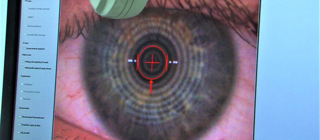 Epidemia krótkowzroczności wśród dzieci