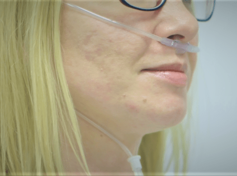 Rehabilitacja pocovidowa. Gdzie szukać pomocy?  - grafika